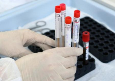 Эпидемиолог: массовое ИФА-тестирование на антитела помогло бы сэкономить госсредства на вакцинации
